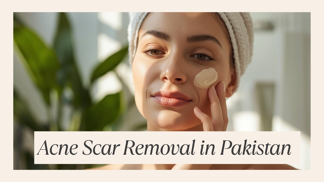 Hymey’s Anti Acne Serum – Best solution for acne scar removal in Pakistan