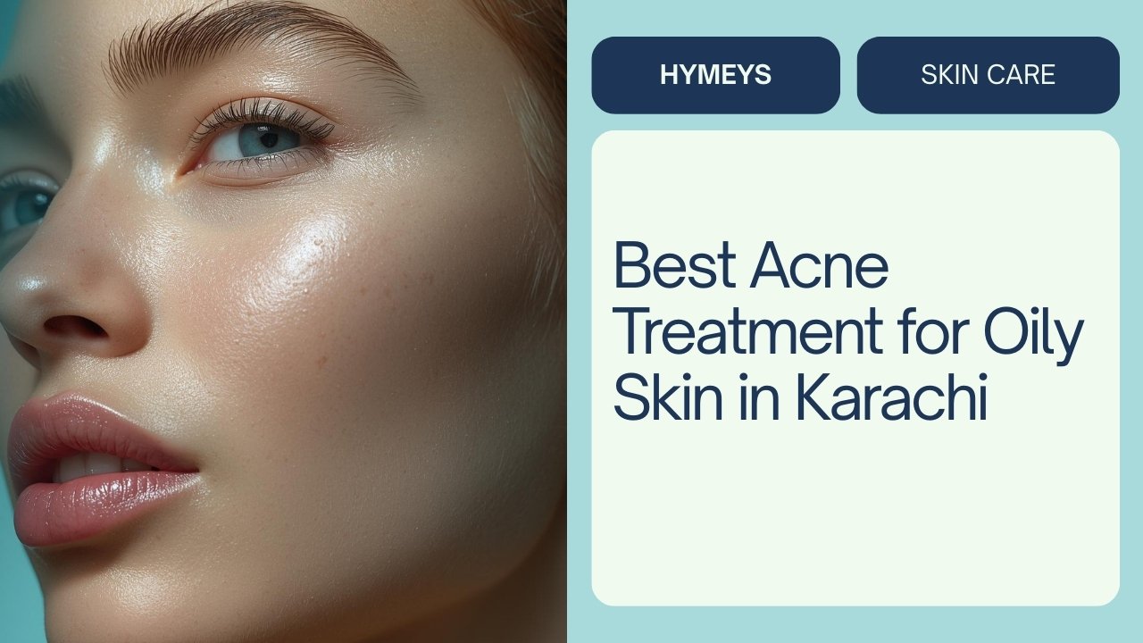 Best acne treatment for oily skin in Karachi with Hymeys Anti Acne Serum – 2026